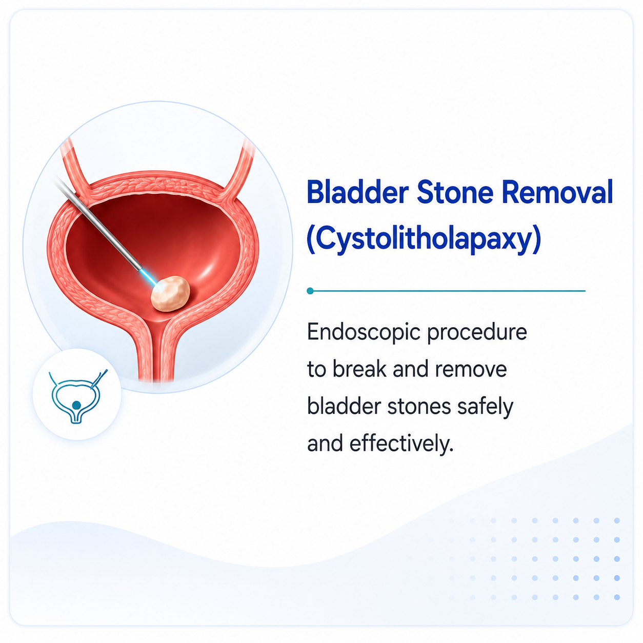 Medical illustration representing medication and conservative care for kidney, ureter, and bladder stones, including hydration, pain management, and medical therapy.