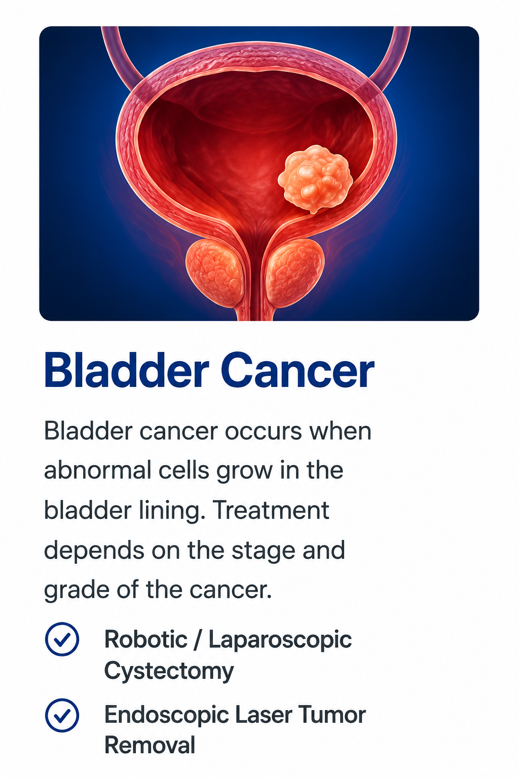 Illustration of bladder cancer showing a bladder tumor with advanced treatment options including robotic or laparoscopic cystectomy and endoscopic laser tumor removal by Dr. Ram Prasad in Hyderabad.