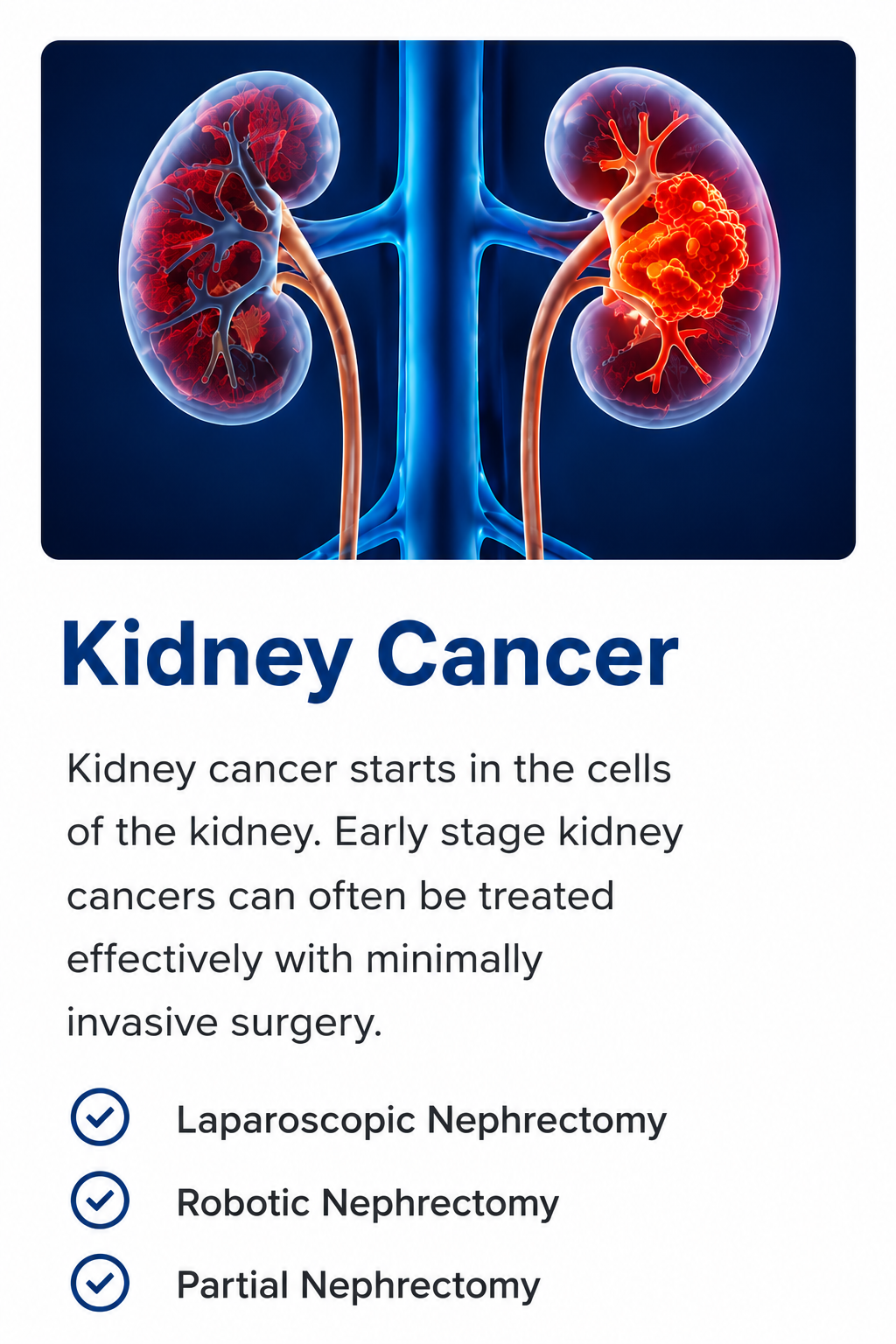 Illustration of kidney cancer showing a tumor in the kidney with advanced treatment options including laparoscopic nephrectomy, robotic nephrectomy, and partial nephrectomy by Dr. Ram Prasad in Hyderabad.