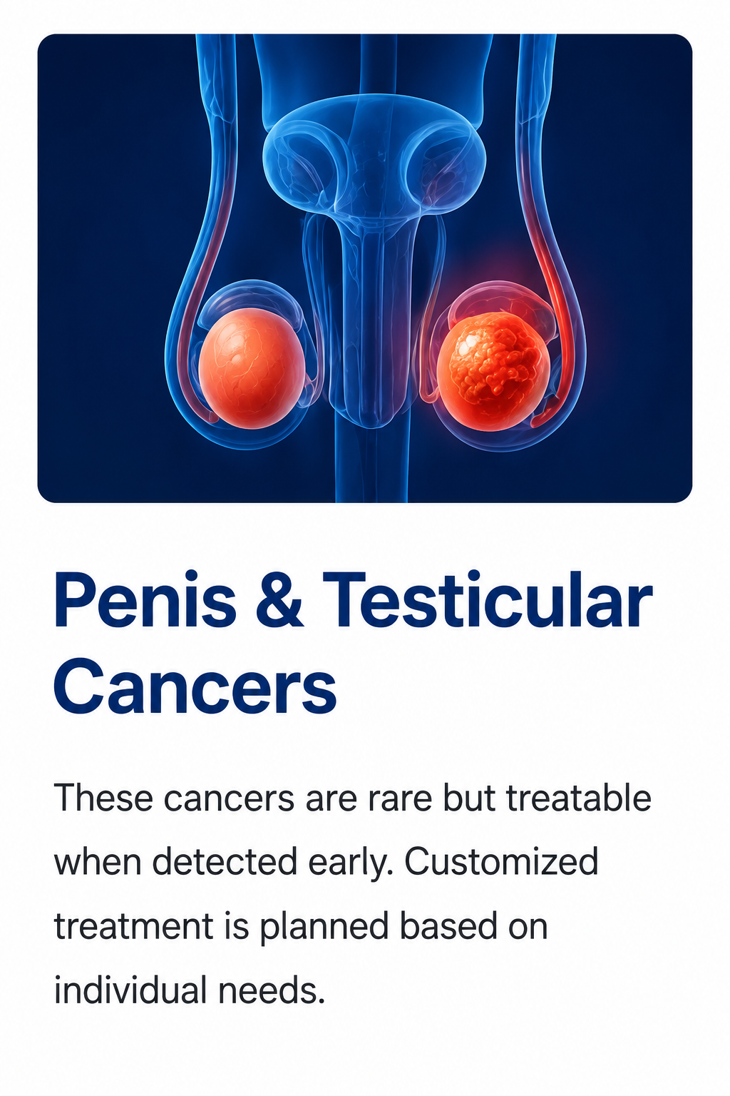 Illustration of penile and testicular cancers showing the male reproductive organs with a testicular tumor, representing advanced diagnosis and treatment by Dr. Ram Prasad in Hyderabad.