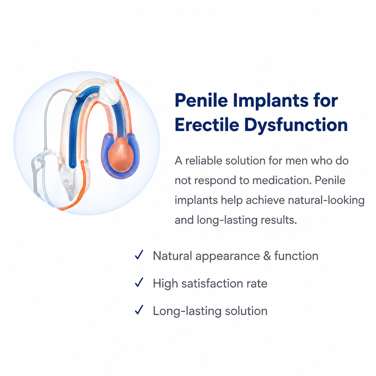 Medical illustration of a penile implant device used to treat erectile dysfunction in men who do not respond to medication.