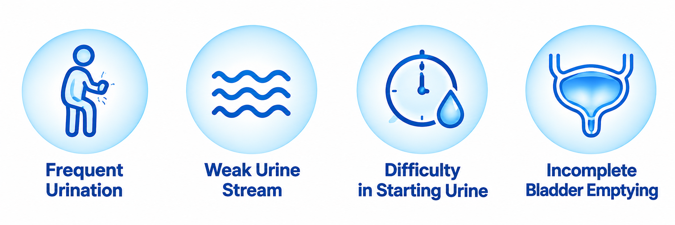 Common symptoms of benign prostatic hyperplasia including frequent urination, weak urine stream, difficulty starting urine, and incomplete bladder emptying