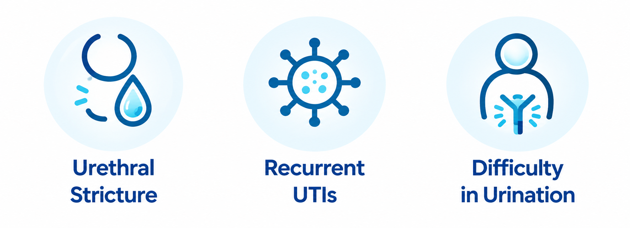 Common urethral stricture symptoms including recurrent UTIs and difficulty in urination