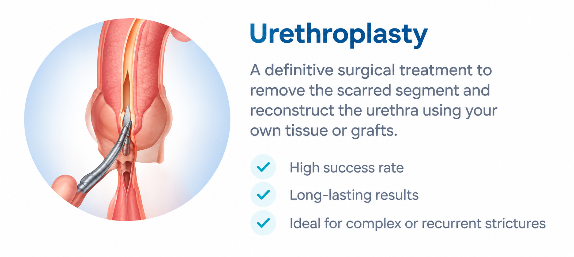 Urethroplasty procedure for urethral stricture treatment by Dr. Ram Prasad